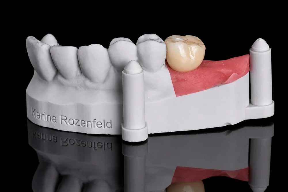 Crown on a Model · Side View