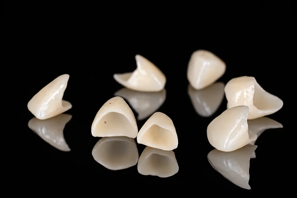 Ceramic Restorations · Intaglio Surface