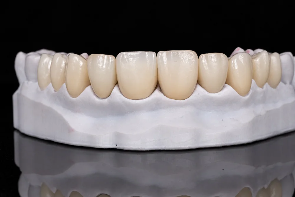 Anterior Crowns · Ceramic Texture